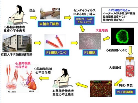iPS細胞の循環器領域への臨床応用 福田恵一教授 | 川村内科診療所様